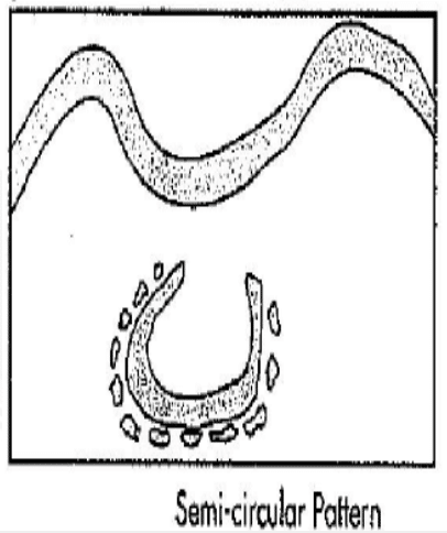 semi circular pattern