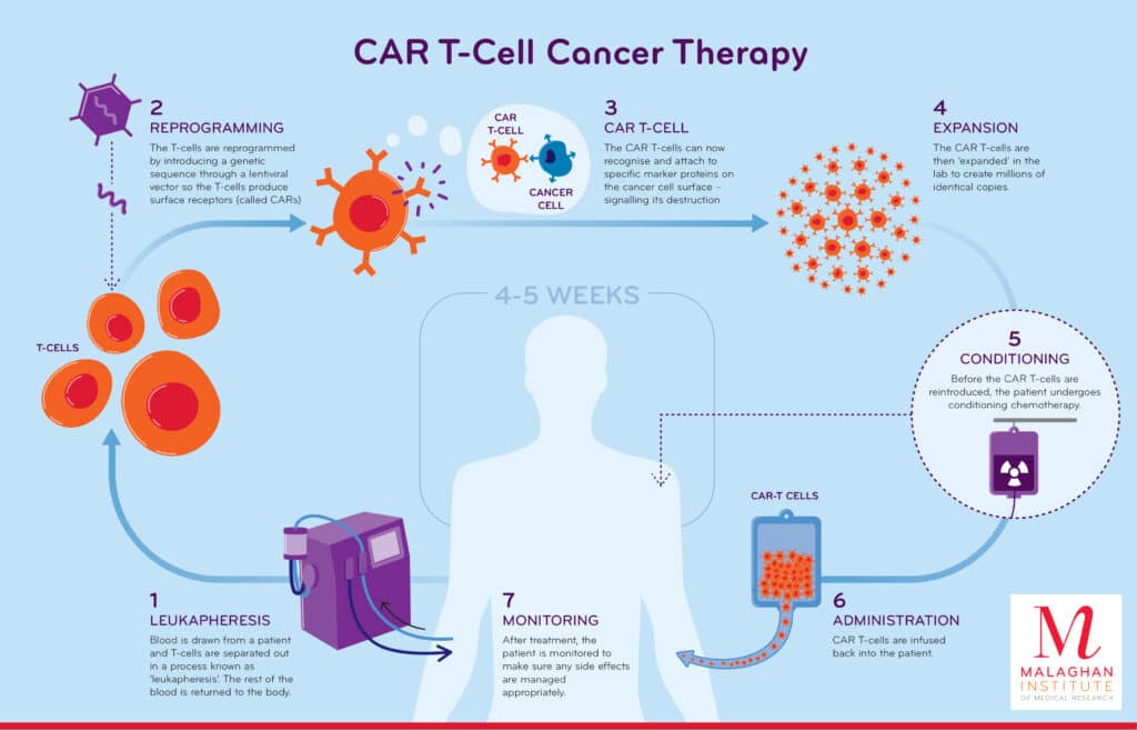 CAR T-cell Therapy UPSC